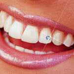piercing-no-dente-precos-cuidados-6-150x150
