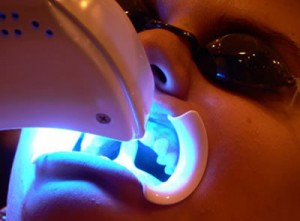 clareamento-dental-300x221