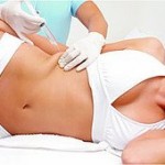 Hidrolipo - Preço, Onde Fazer, Funciona