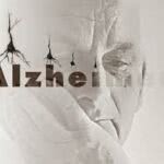 Alzheimer - O que é, Sintomas, Causas, Tratamento