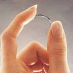Essure - O que é, Preço, Efeitos Colaterais